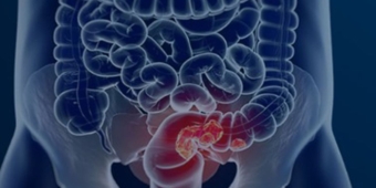 Imagem de capa da notícia