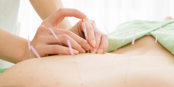 Foto de capa da notícia