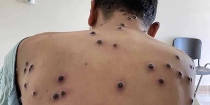 Foto de capa da notícia